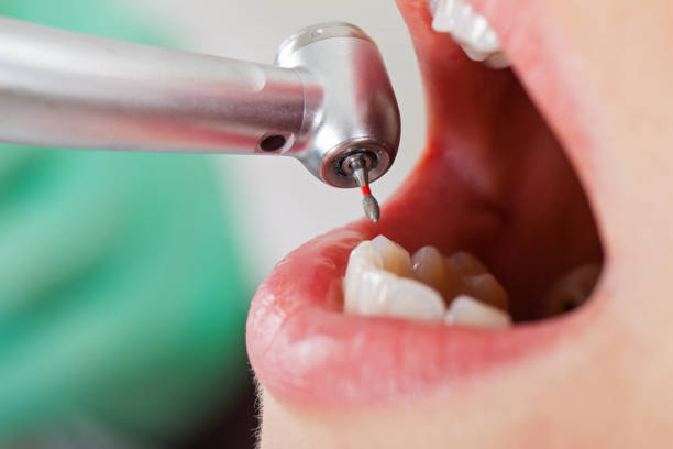 Best Dentist Open on Weekends  in Earlvle, IL